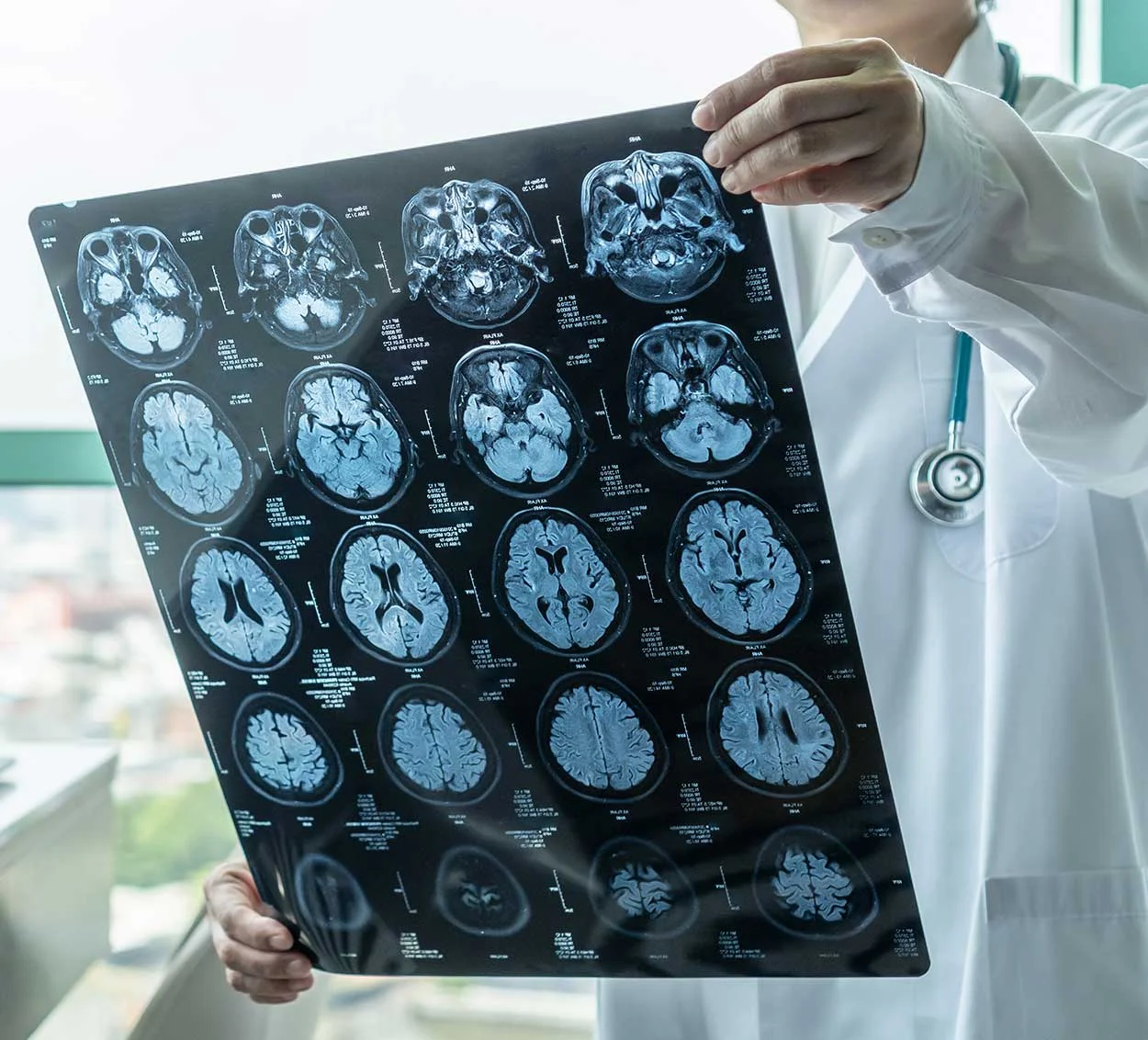 Subespecialização em Ressonância Magnética